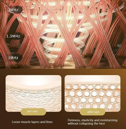 Electric EMS Neck & Face Lifting Massager – Skin Tightening Device for Anti-Wrinkle & Double Chin Removal